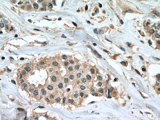 [67647-1-IG-20UL] PPM1B Monoclonal antibody