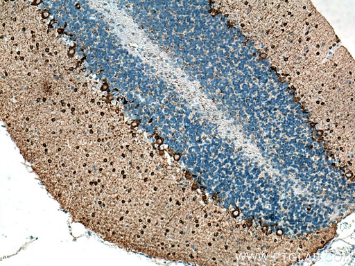 [67648-1-IG-150UL] GAD1 Monoclonal antibody