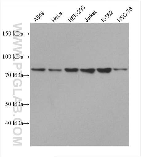 [67649-1-IG-150UL] GNE Monoclonal antibody