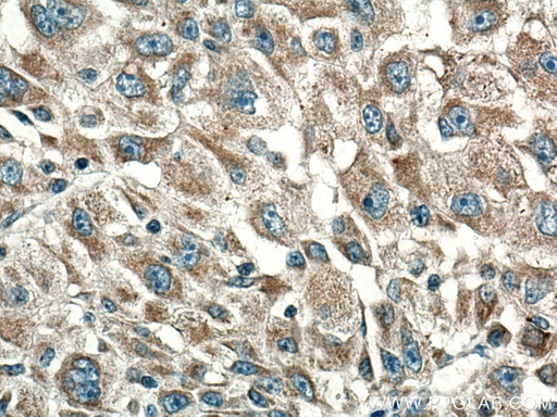 [67656-1-IG-20UL] CYR61 Monoclonal antibody