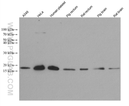 [67657-1-IG-150UL] Destrin Monoclonal antibody