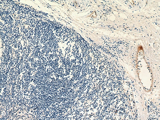 [67658-1-IG-150UL] PROCR Monoclonal antibody