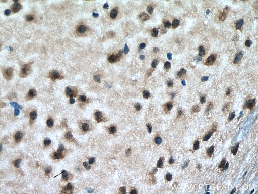 [67659-1-IG-20UL] RAB18 Monoclonal antibody