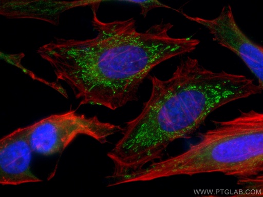 [67665-1-IG-20UL] SNX5 Monoclonal antibody