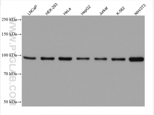 [67671-1-IG-150UL] FER Monoclonal antibody