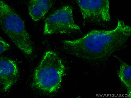 [67681-1-IG-150UL] NOX4 Monoclonal antibody