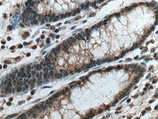 [67682-1-IG-20UL] PSMD5 Monoclonal antibody