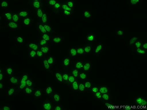[67687-1-IG-20UL] ANP32A Monoclonal antibody