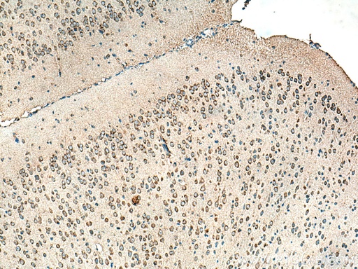 [67689-1-IG-150UL] ALPK1 Monoclonal antibody