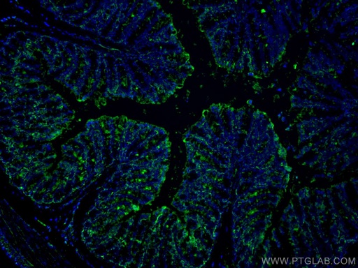 [67691-1-IG-150UL] FABP2 Monoclonal antibody
