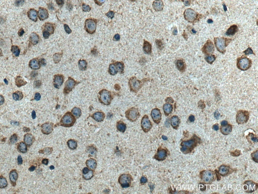 [67693-1-IG-150UL] TRAP1 Monoclonal antibody