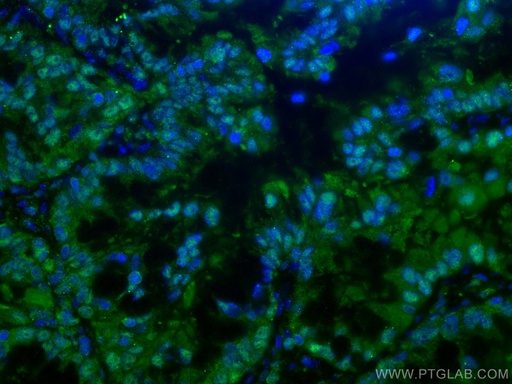 [67695-1-IG-150UL] PSMA6 Monoclonal antibody