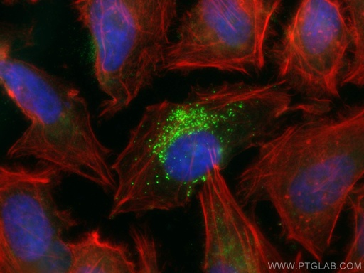 [67696-1-IG-20UL] SNF8 Monoclonal antibody