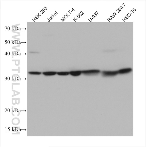 [67697-1-IG-150UL] FBXO6 Monoclonal antibody