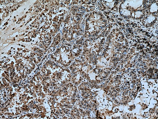 [67698-1-IG-150UL] YWHAZ Monoclonal antibody