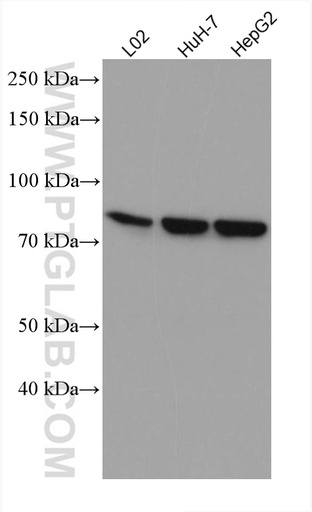 [67700-1-IG-20UL] SLC6A12 Monoclonal antibody