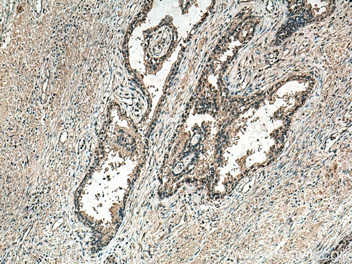 [67707-1-IG-150UL] MAP3K7 Monoclonal antibody
