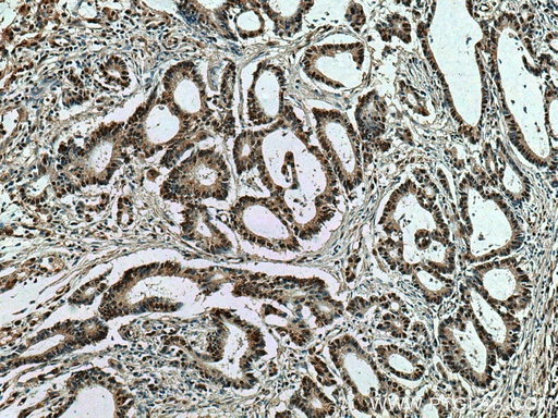 [67708-1-IG-150UL] HNRNPK Monoclonal antibody