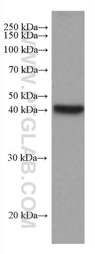 [67709-1-IG-20UL] ADH6 Monoclonal antibody