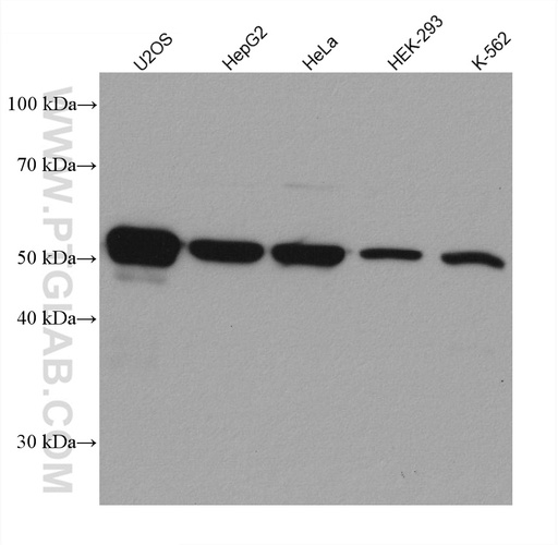 [67724-1-IG-20UL] ILK Monoclonal antibody