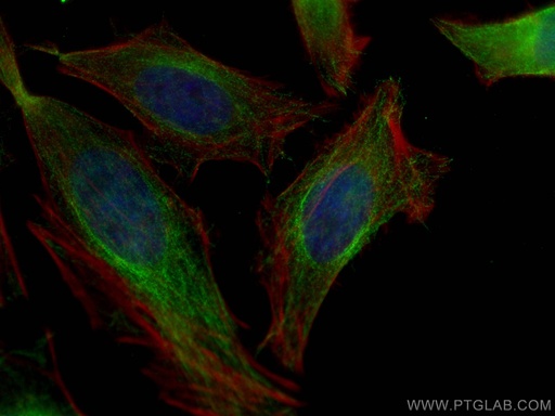 [67727-1-IG-150UL] ATG4B Monoclonal antibody