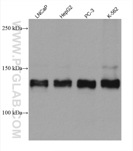 [67730-1-IG-20UL] ZNF217 Monoclonal antibody