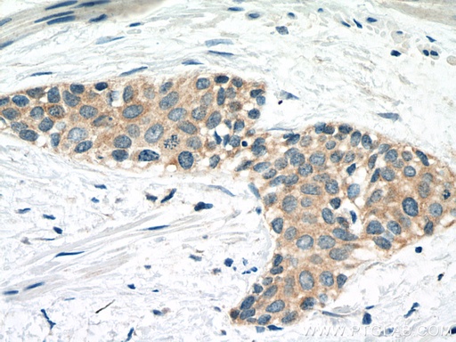 [67732-1-IG-20UL] CAPN1 Monoclonal antibody