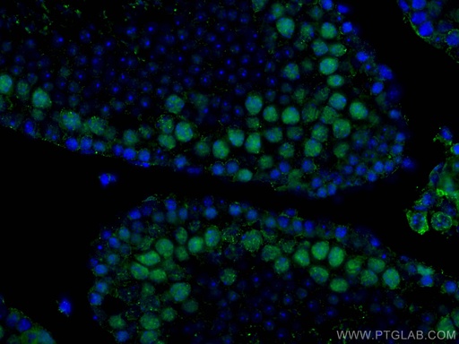 [67733-1-IG-150UL] METTL3 Monoclonal antibody