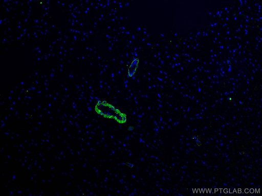[67735-1-IG-150UL] smooth muscle actin specific Monoclonal antibody