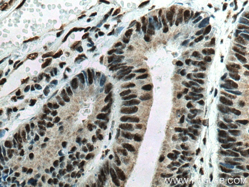 [67740-1-IG-150UL] EIF4A3 Monoclonal antibody