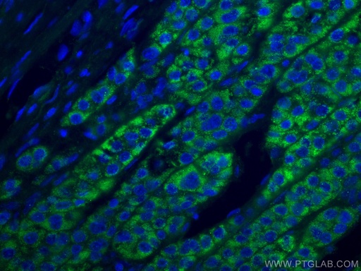 [67742-1-IG-150UL] ACADM Monoclonal antibody