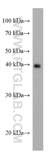 [67743-1-IG-20UL] AgBR1 Monoclonal antibody