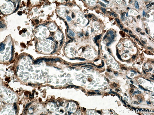 [67744-1-IG-150UL] PTPN14 Monoclonal antibody
