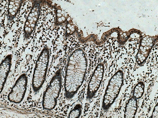 [67748-1-IG-150UL] PSMB9 Monoclonal antibody
