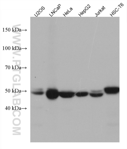 [67751-1-IG-20UL] PRKAR2A Monoclonal antibody