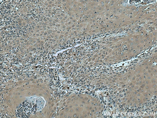 [67753-1-IG-20UL] VASH2 Monoclonal antibody