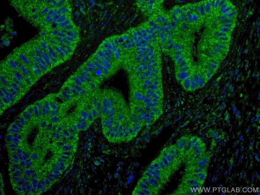 [67754-1-IG-20UL] ING4 Monoclonal antibody