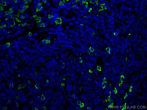 [67762-1-IG-20UL] Human IgG lambda chain Monoclonal antibody