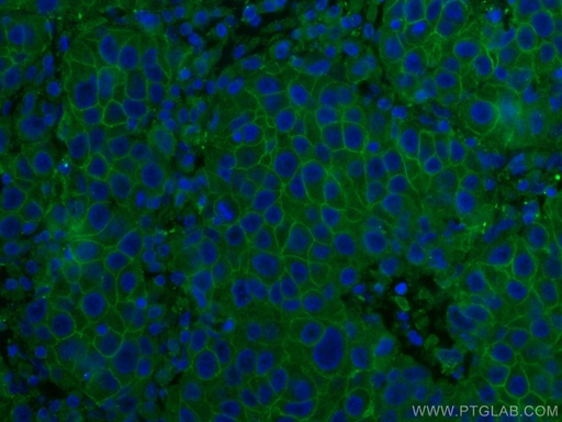 [67768-1-IG-20UL] ALCAM Monoclonal antibody