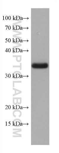 [67773-1-IG-150UL] TMEM74 Monoclonal antibody