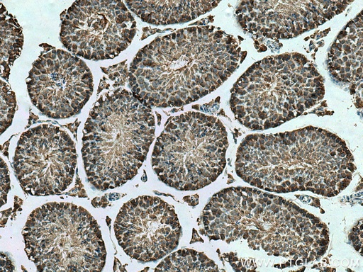[67774-1-IG-20UL] KLHL25 Monoclonal antibody