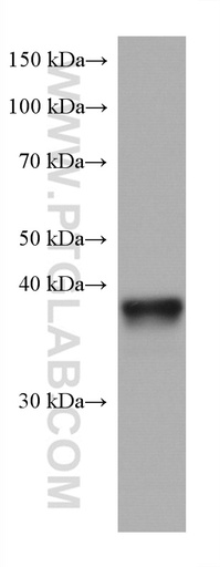 [67775-1-IG-20UL] ANKRD1 Monoclonal antibody