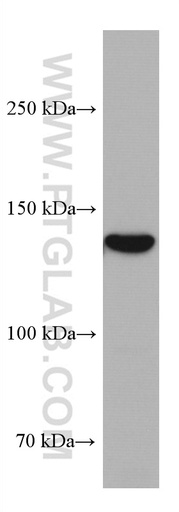 [67782-1-IG-150UL] GUCY2C Monoclonal antibody