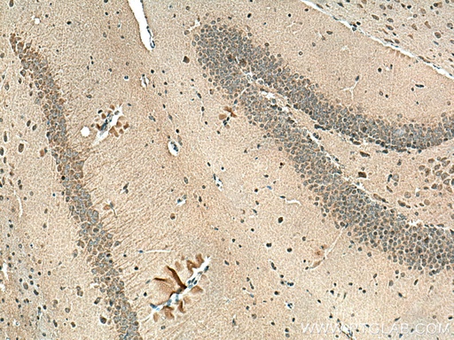 [67783-1-IG-150UL] PPP2R2B Monoclonal antibody