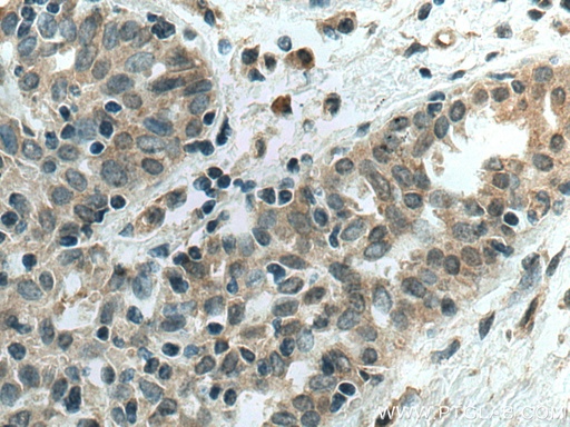 [67785-1-IG-150UL] AHR Monoclonal antibody