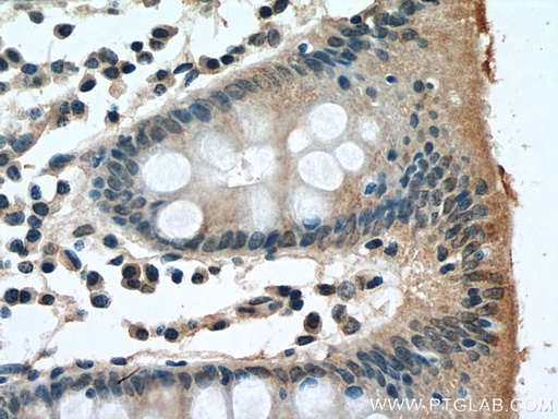 [67787-1-IG-20UL] TK1 Monoclonal antibody