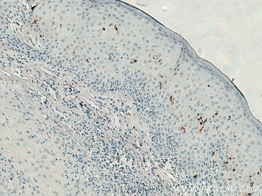 [67788-1-IG-20UL] CD207 Monoclonal antibody