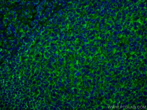[67789-1-IG-150UL] NT5E,CD73 Monoclonal antibody