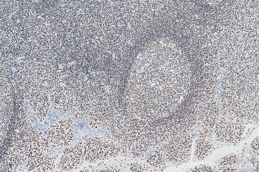 [67790-1-IG-150UL] IFI16 Monoclonal antibody