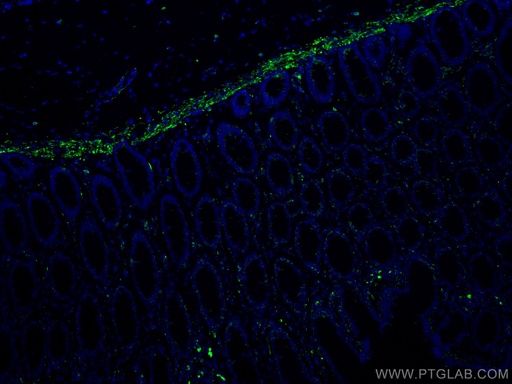 [67793-1-IG-20UL] Desmin Monoclonal antibody